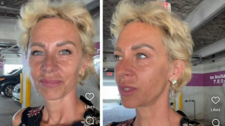 Ужасяващо! Нана Гладуиш: Имам рак на кожата! (Тъкмо оздравя от рака на гърдата)